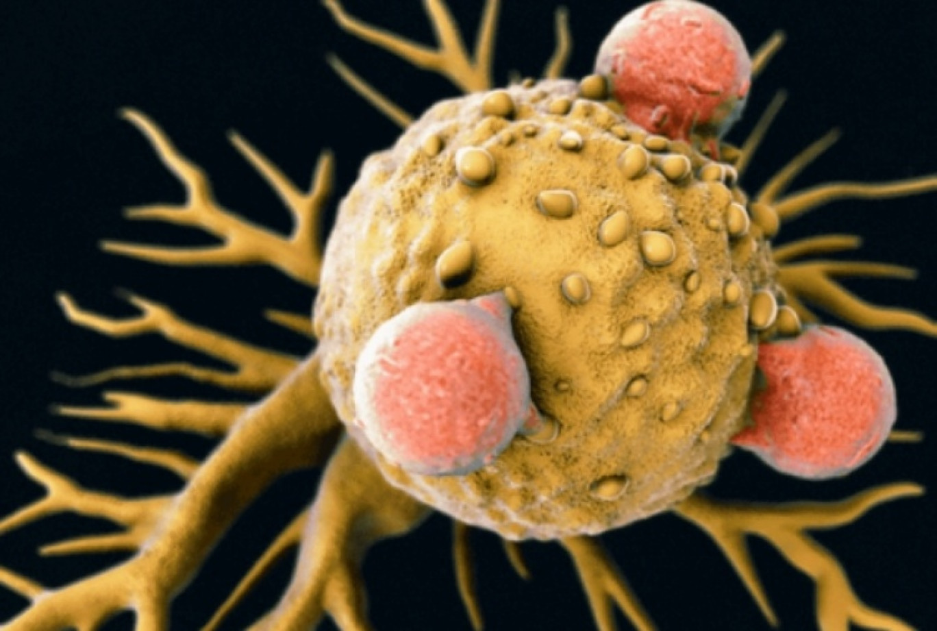 E stata identificata una nuova cellula T che promette di uccidere tutti i tipi di cancro