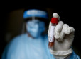 Coronavirus, immunità a tempo limitato. Gli anticorpi durano solo un mese nei pazienti guariti