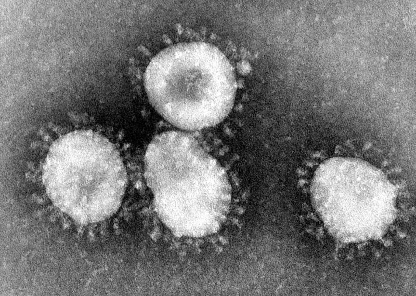 Servono 15 minuti a 90 gradi per distruggere il coronavirus in laboratorio