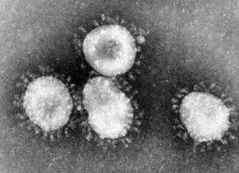 Servono 15 minuti a 90 gradi per distruggere il coronavirus in laboratorio